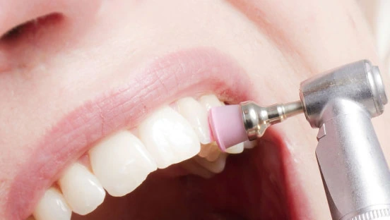 Affordable and Best Oral Hygiene in Juhu - Mumbai