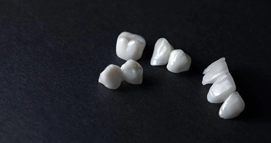 Dental Crowns and Bridges - Opal Dental Care Studio in Mumbai