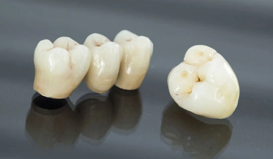 Best Teeth Restoration Treatment for Tooth Decay in Juhu - Mumbai