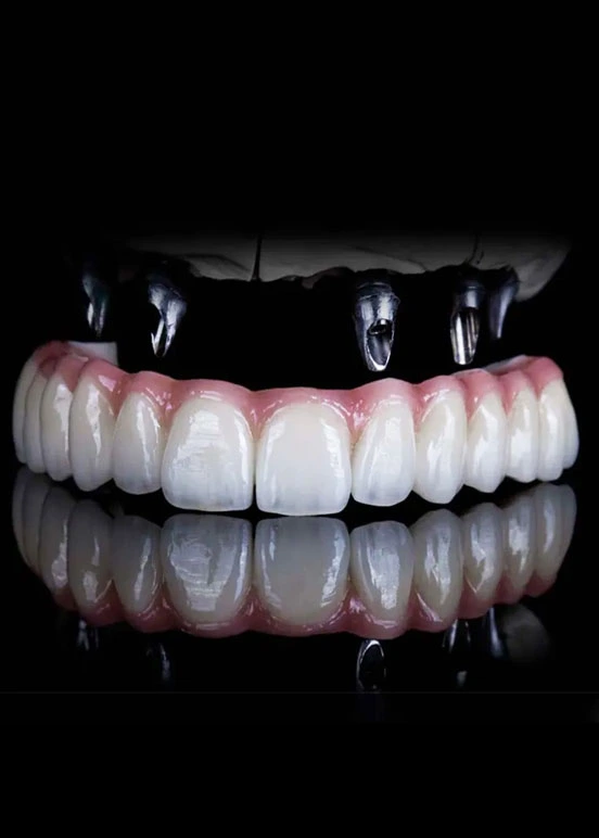 Tooth Extraction Treatment in Juhu - Mumbai