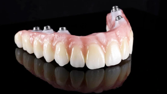 Best Full Mouth Rehabilitation Procedure in Mumbai - Opal Dental Care Studio