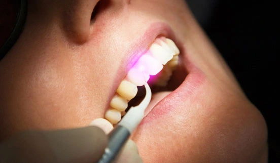 Bad Breath Treatment in Juhu - Mumbai