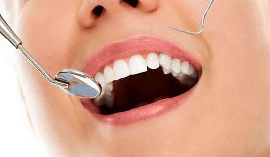 Affordable Composite Filling Treatment in Juhu - Mumbai