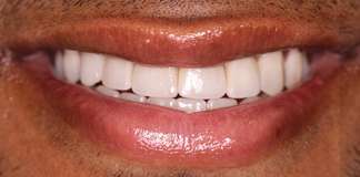 Dr. Aastha Chandra Transforming Smiles At Opal Dental Care Studio, Mumbai, India