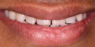 Dr. Aastha Chandra Transforming Smiles At Opal Dental Care Studio, Mumbai, India
